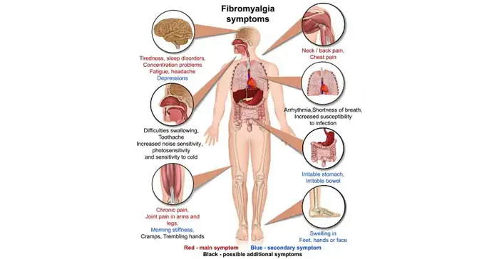 worldcrutches-Fibromyalgia