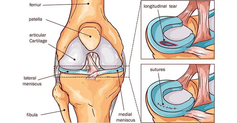 Meniscus-Anatomy-worldcrutches